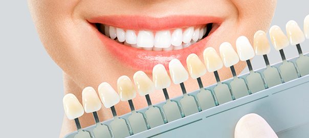 Reasons You Need Teeth Whitening